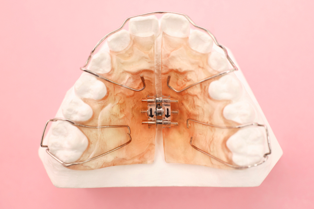 バイオブロック療法